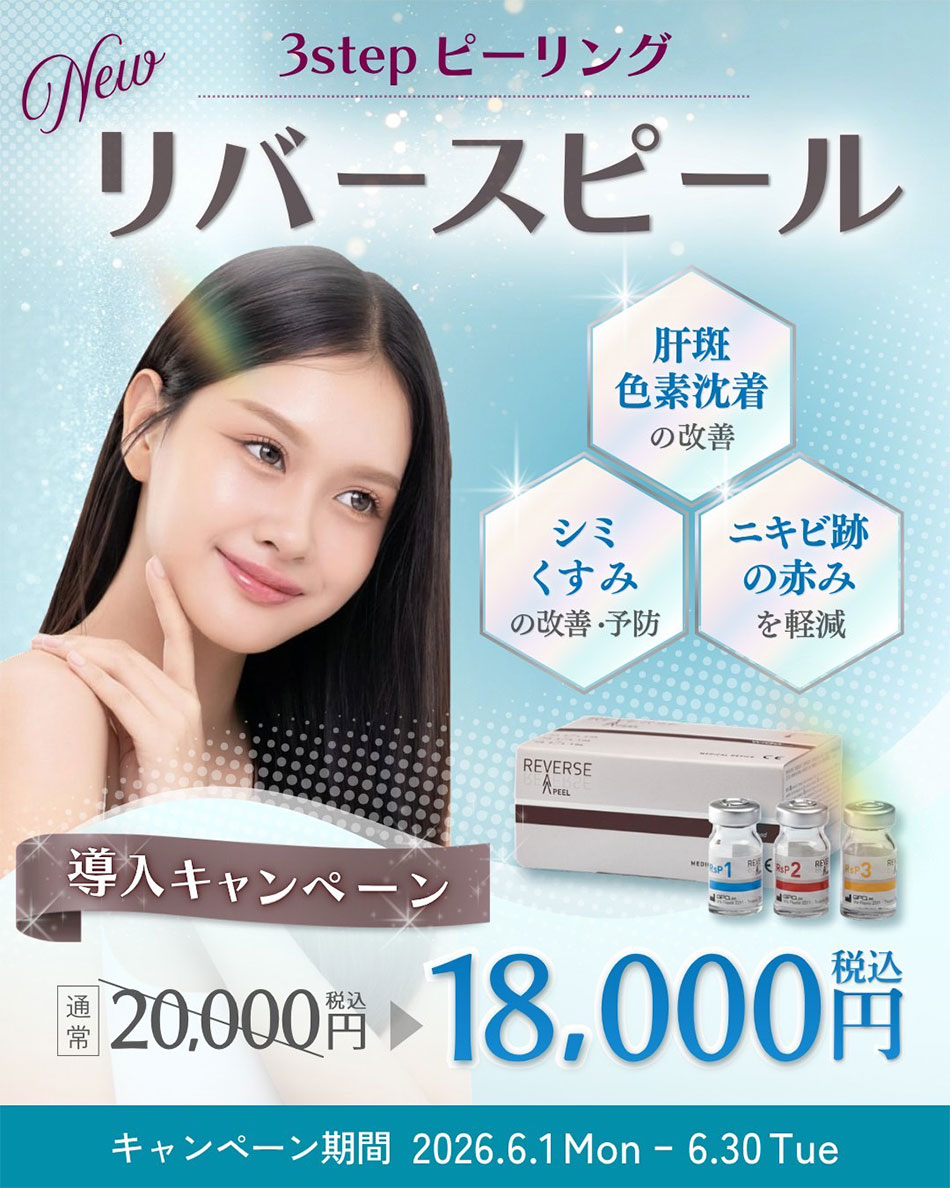 リバースピール